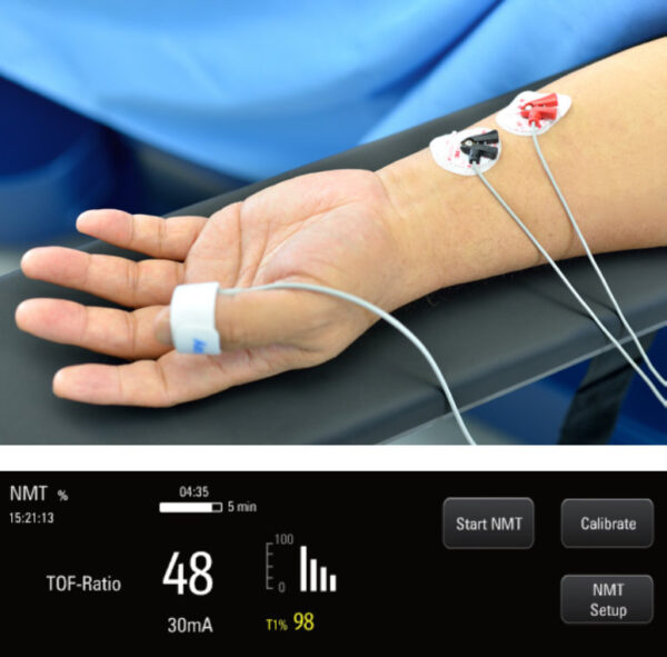 A7-Monitoreo-NMT-para-un-tiempo-de-intubacion-optimo.jpg Máquina de Anestesia Mindray A7