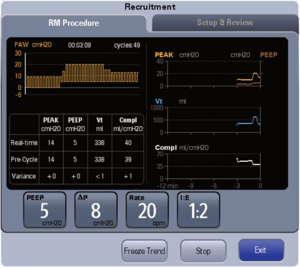 A7-Reclutamiento-pulmonar.jpg Máquina de Anestesia Mindray A7